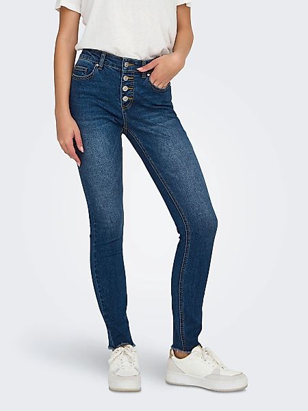 ONLY Skinny-fit-Jeans "ONLMIA MID WAIST BUTTON SK RW ANK BOX" günstig online kaufen