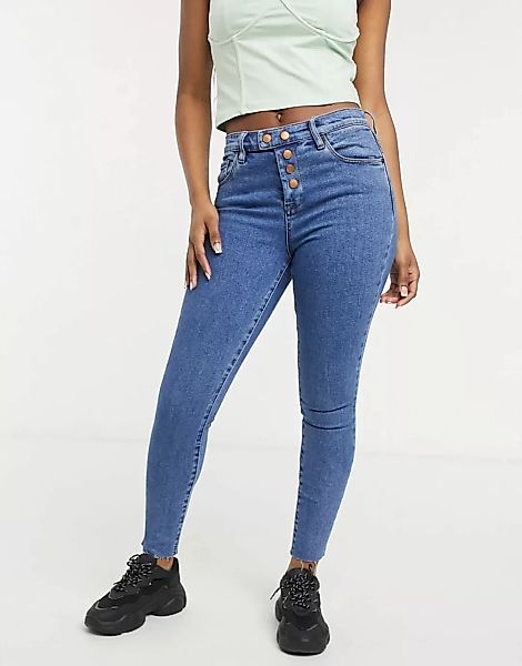Blank NYC – Enge Jeans in College-Mittelblau mit freiliegendem Knopfverschl günstig online kaufen