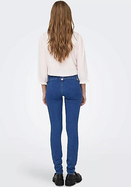 ONLY Skinny-fit-Jeans ONLROYAL REG SK VIS BUT DET DNM PIM günstig online kaufen